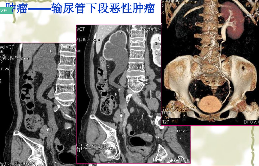 放射科新技術介紹