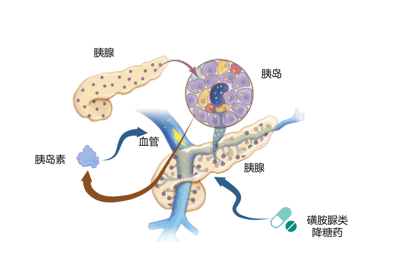 磺酰脲類降糖藥用藥小常識(shí)